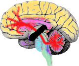 cerebello cerebral disconnection